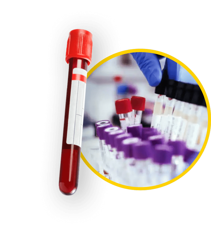 blood-drug-test_optimized